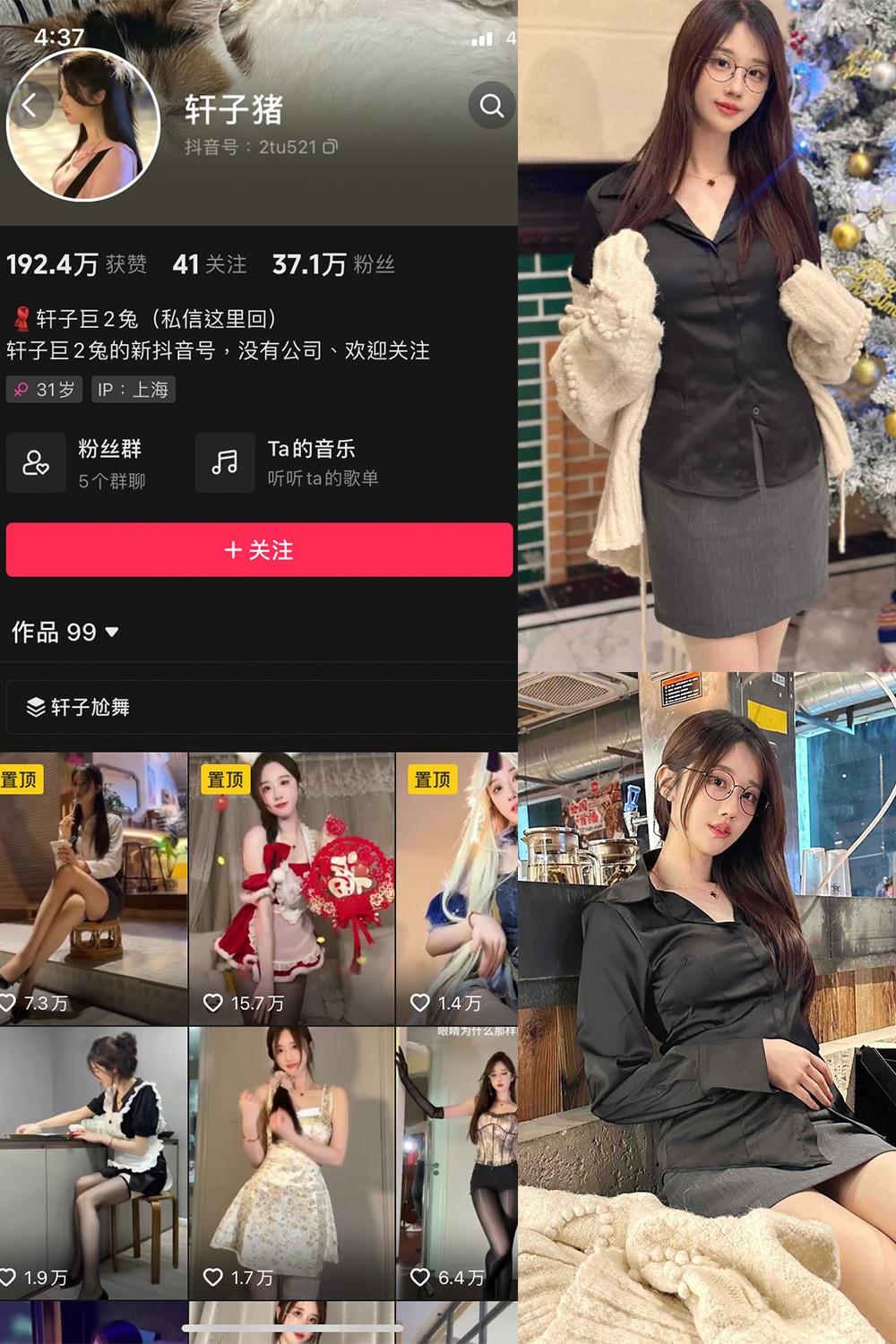 抖音 轩子巨二兔 微密圈图包资源  NO.016期 【10P】
