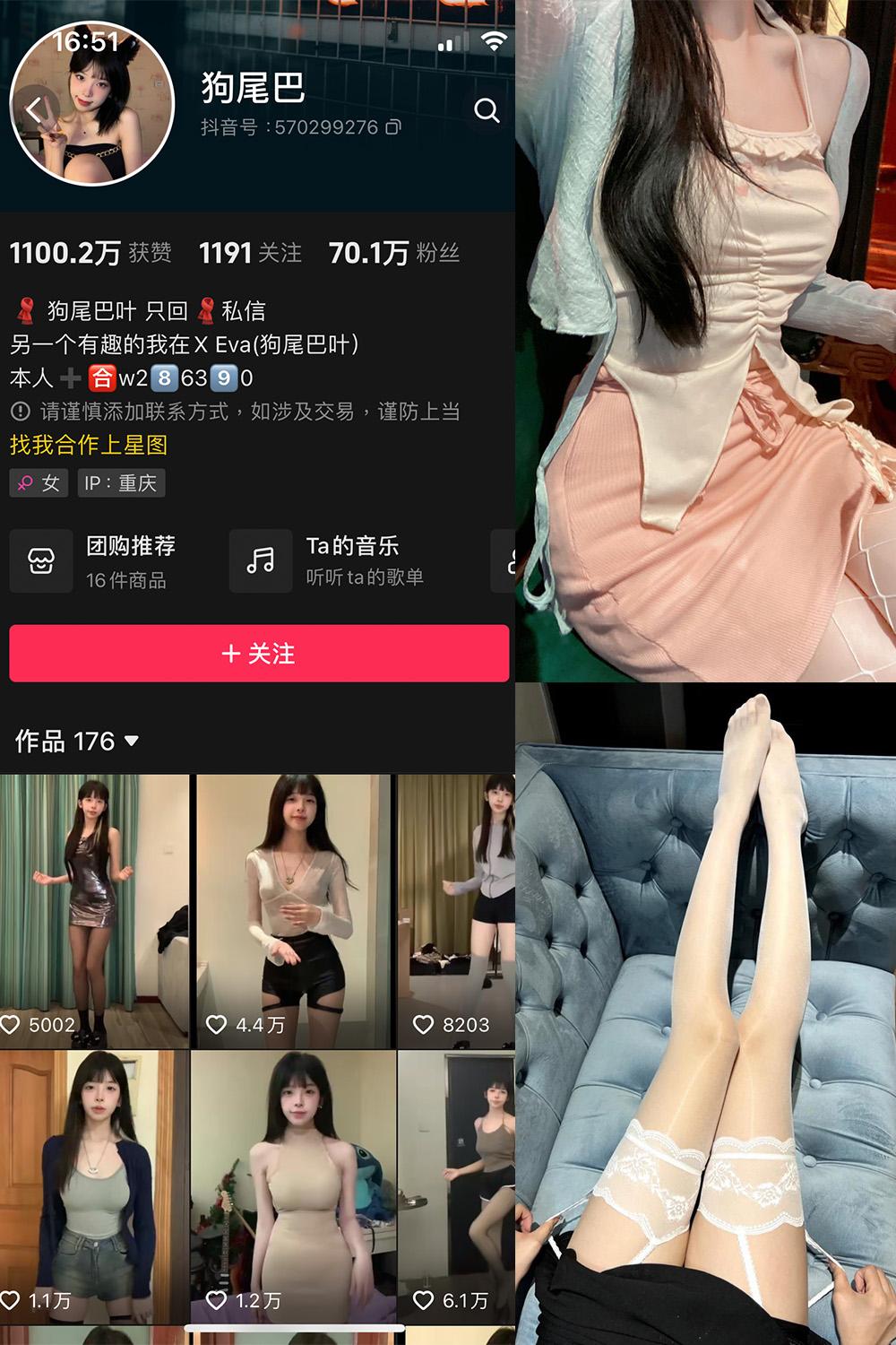 抖音 狗尾巴 微密圈图包资源  NO.005期 【40P10V】