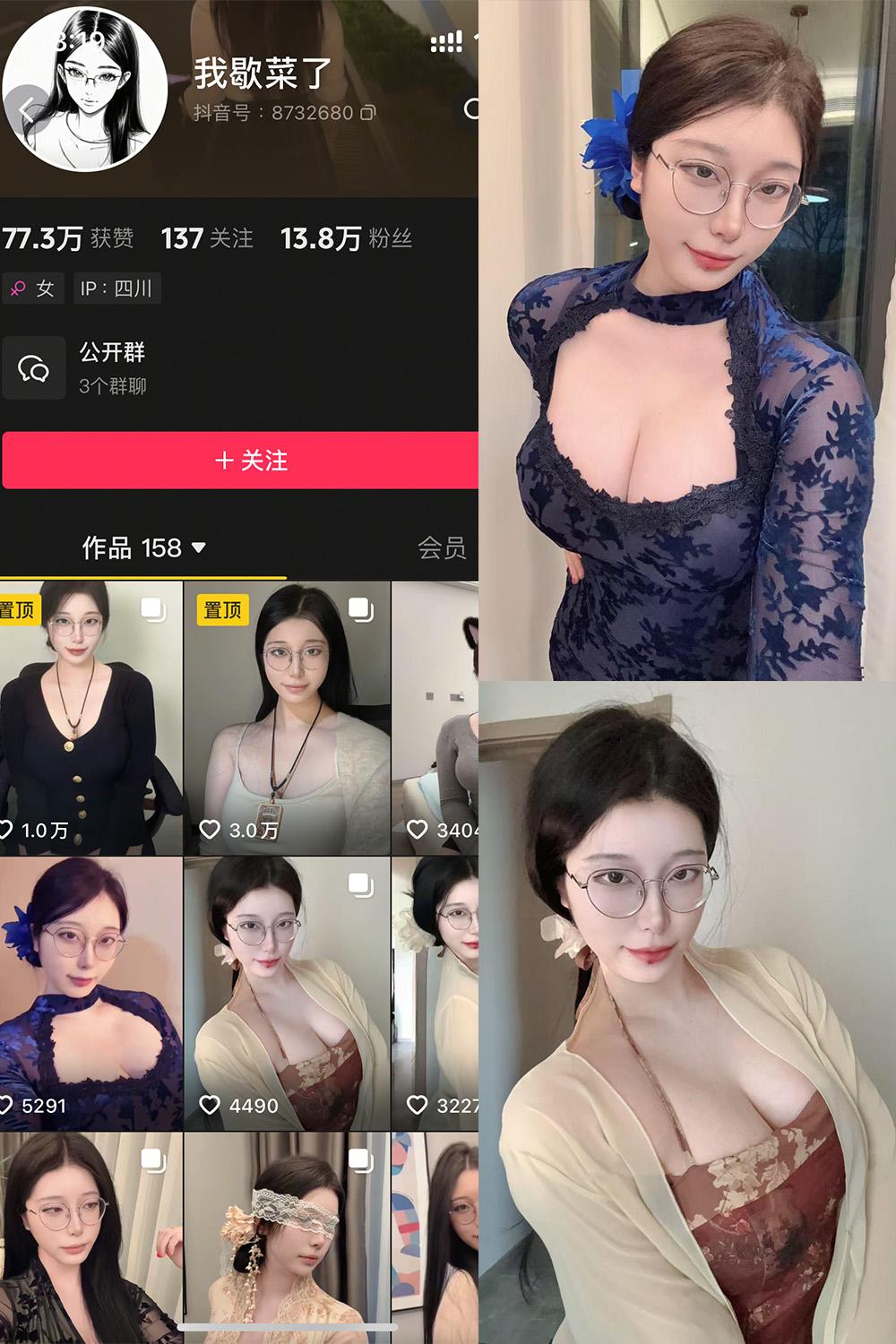 抖音 我歇菜了 微密圈图包资源 NO.001期 【10P】