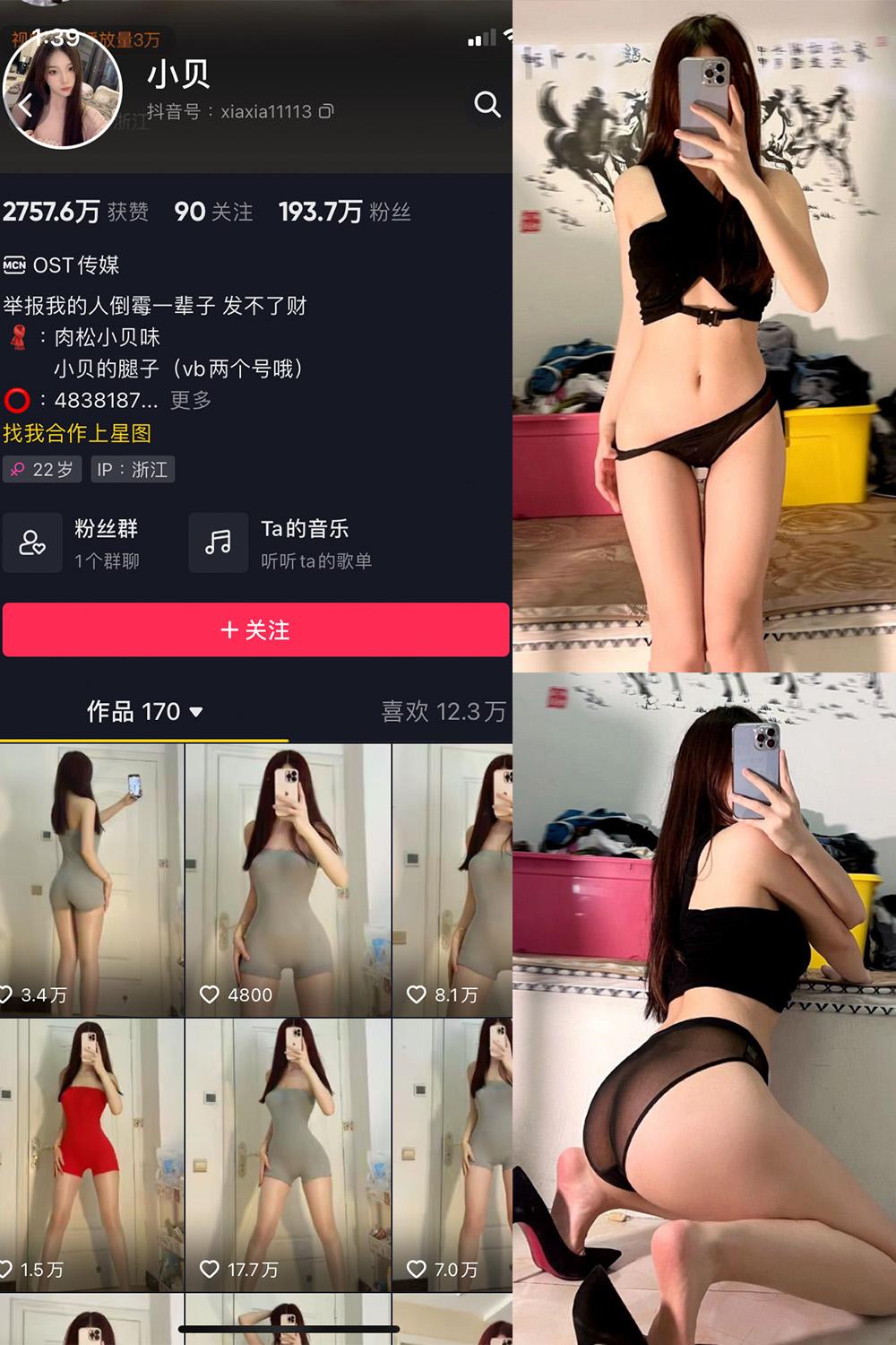 抖音 小贝 VIP 微密圈图包资源  NO.003期 【32P】