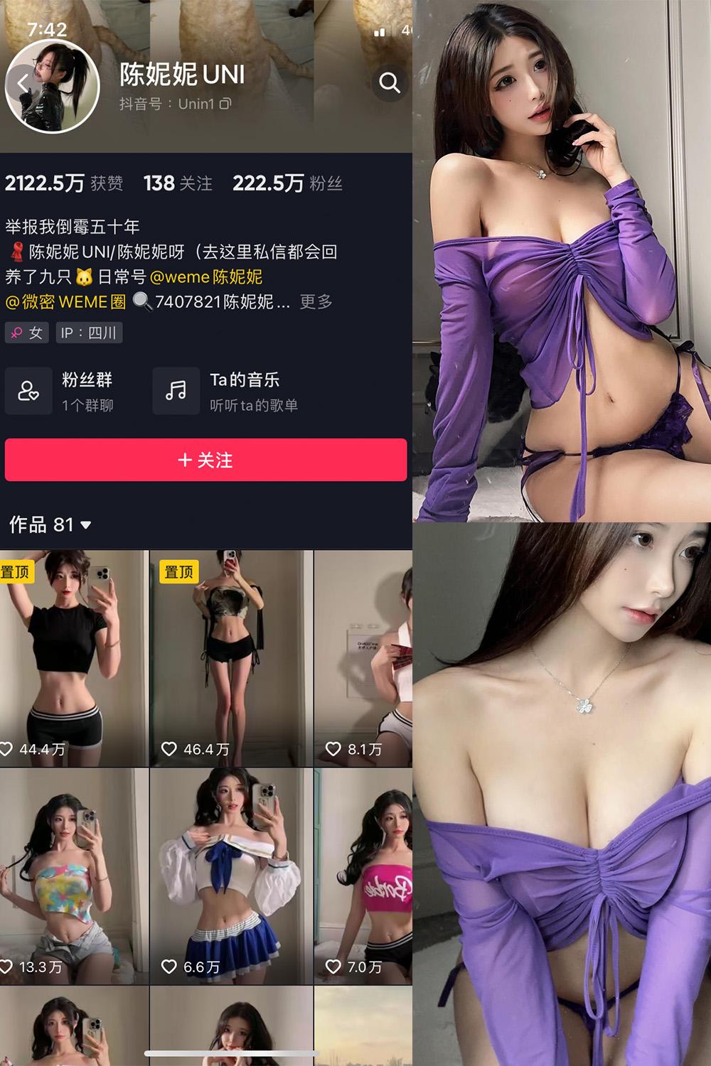 抖音 陈妮腻UNI 微密圈图包资源  NO.072期 【21P1V】
