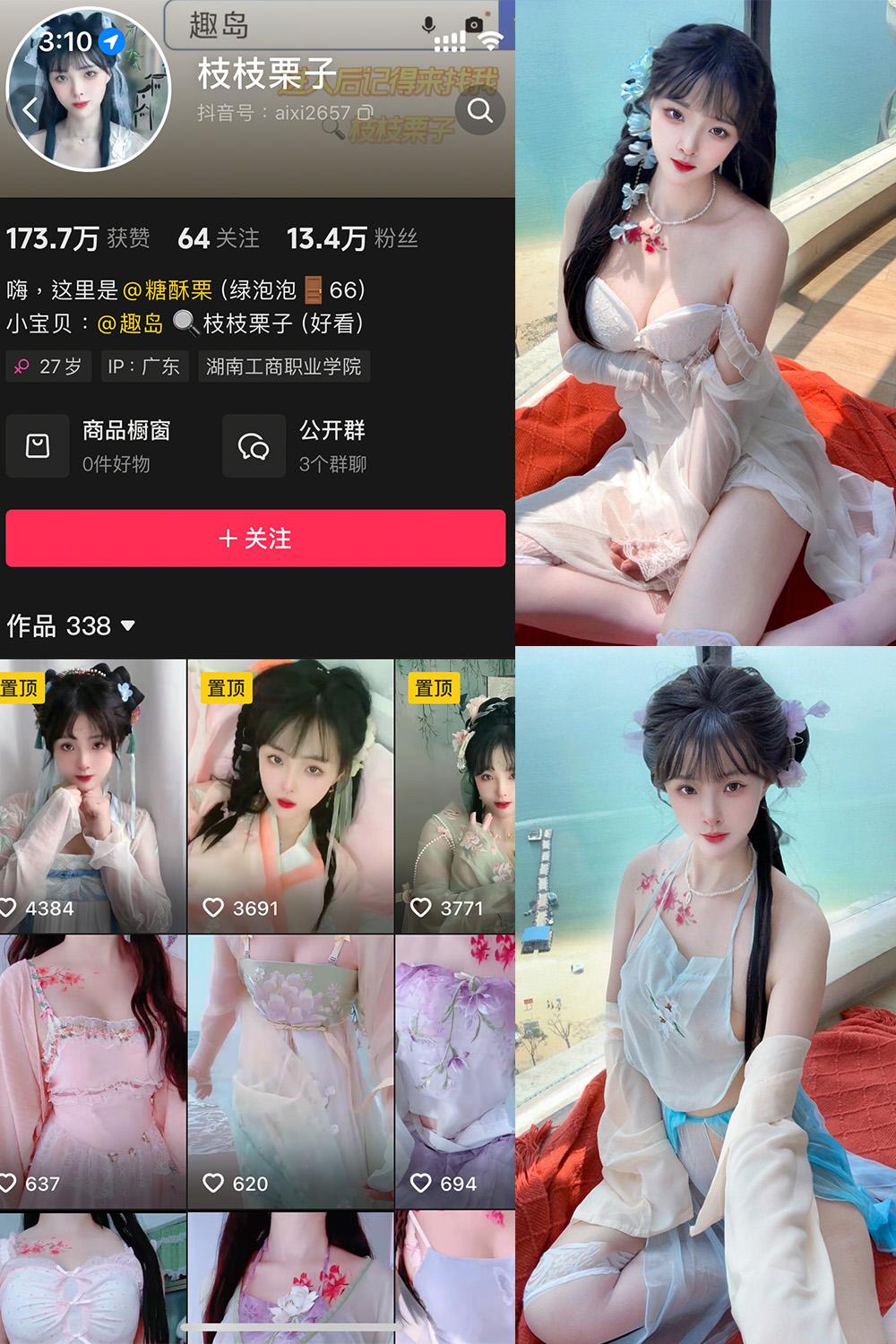 抖音 枝枝栗子 微密圈图包资源  NO.002期 【15P7V】