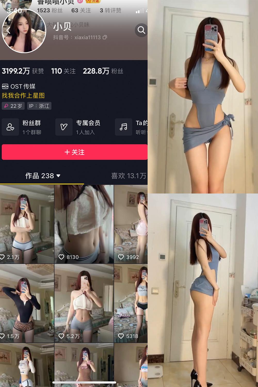 抖音 小贝 VIP 微密圈图包资源 NO.014期 【6P10V】