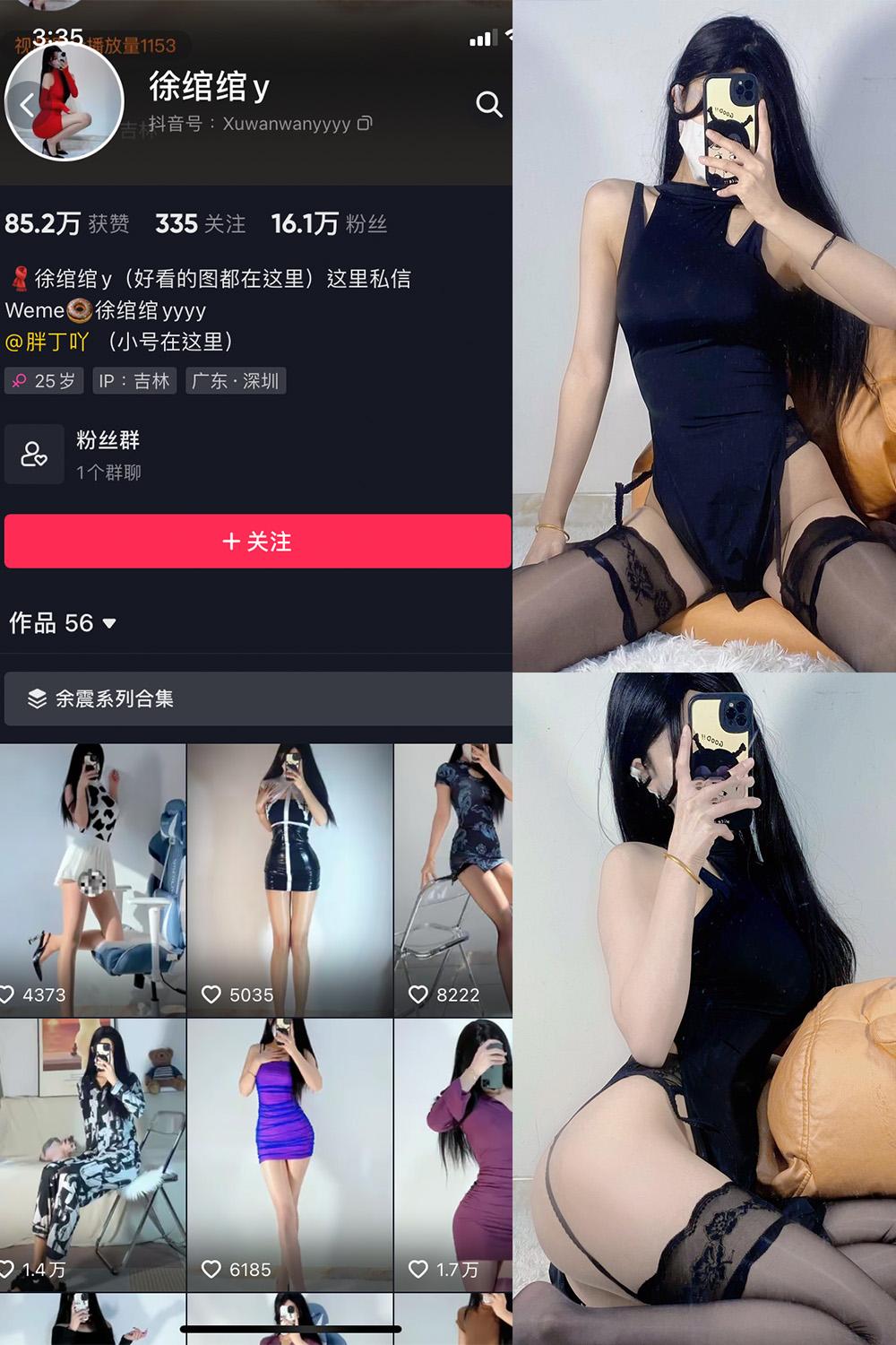 抖音 徐绾绾 微密圈图包资源  NO.014期 【39P7V】