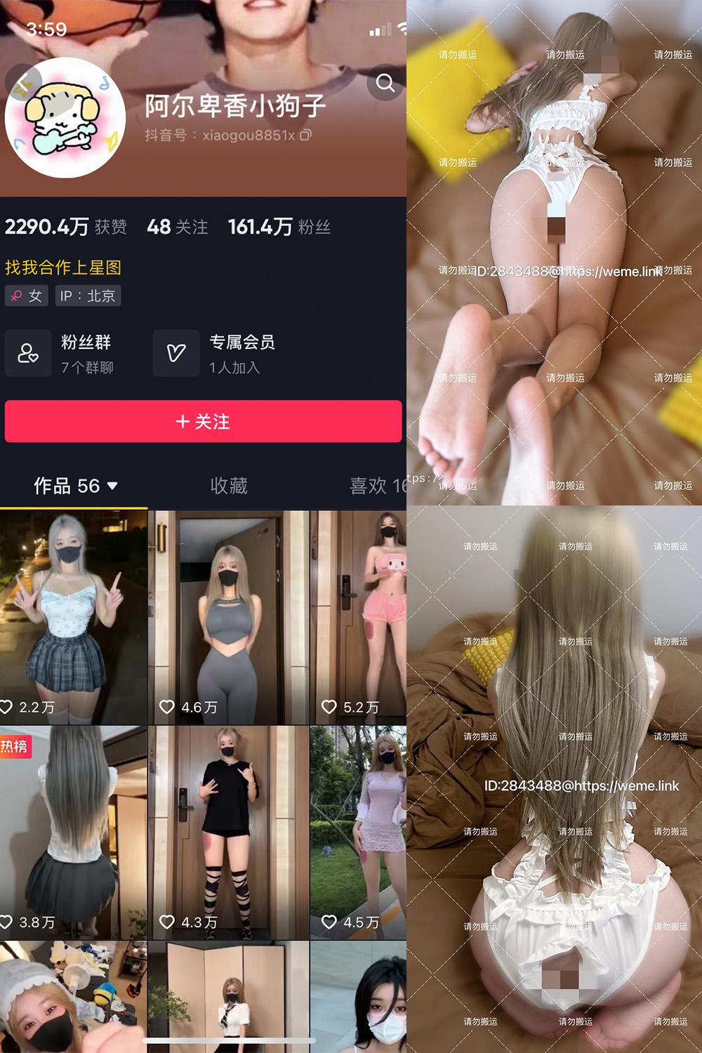 抖音 阿尔卑香小狗子 微密圈图包资源  NO.018期 【16P1V】