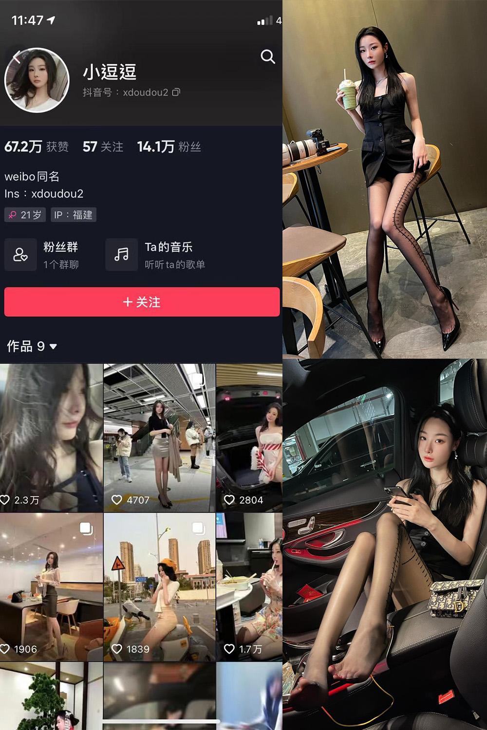 抖音 小逗逗 微密圈图包资源  NO.022期 【14P】