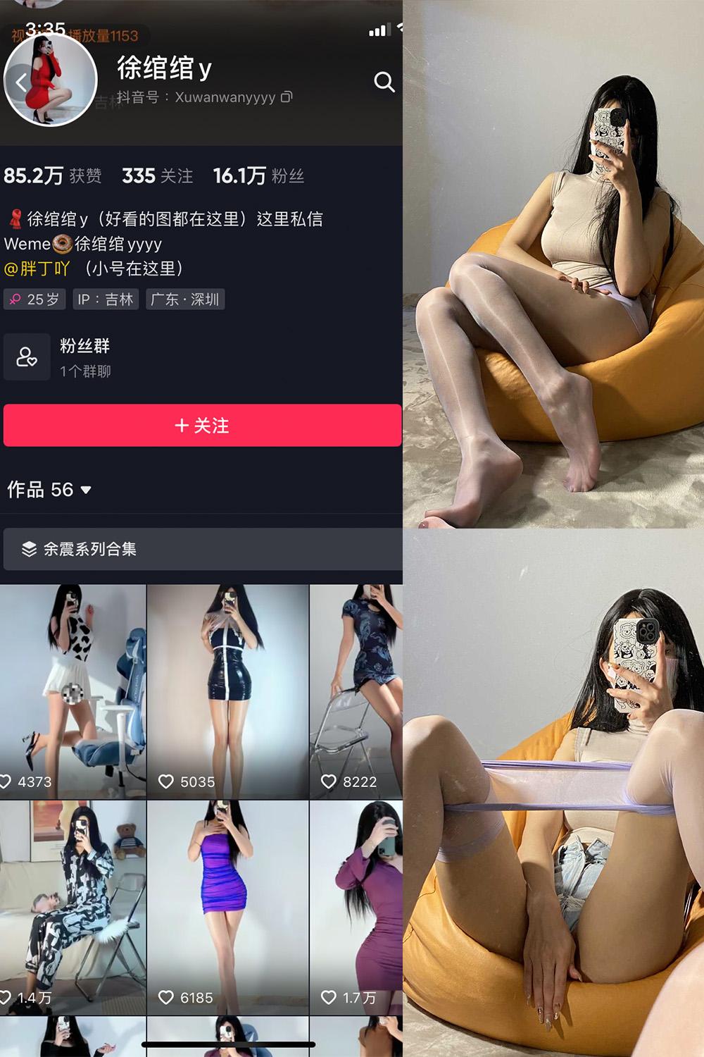 抖音 徐绾绾 微密圈图包资源  NO.001期 【37P】