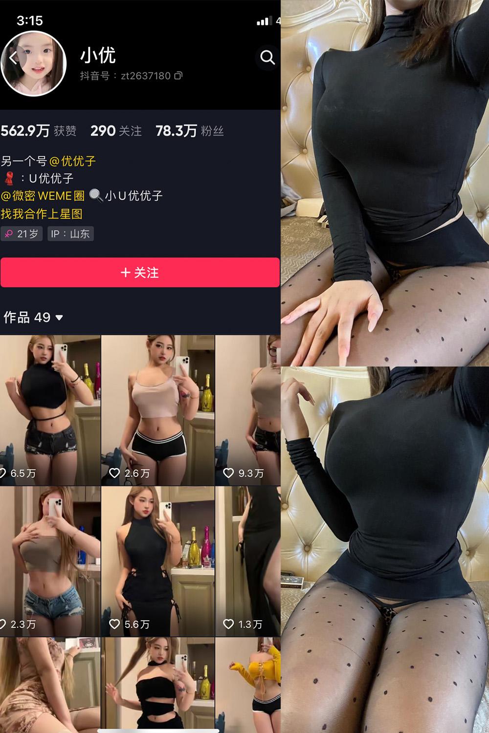 抖音 小U优优子 VIP 微密圈图包资源  NO.027期 【25P5V】