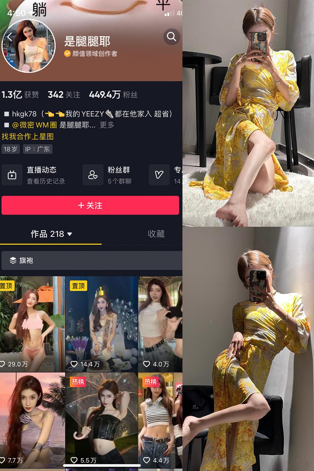抖音 是腿腿耶 微密圈图包资源  NO.026期 【6P】