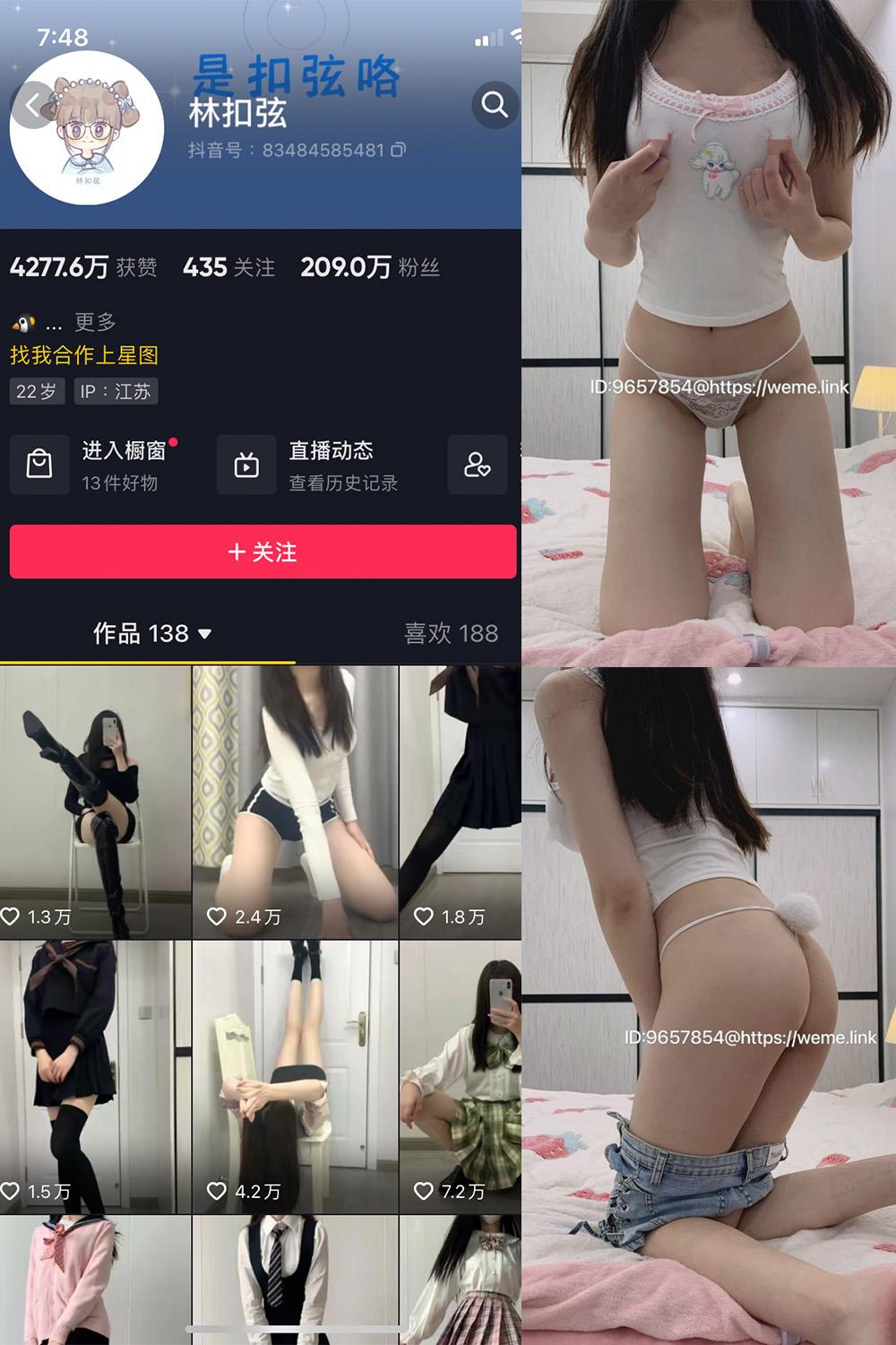抖音 林扣弦 微密圈图包资源 NO.070期 【25P】