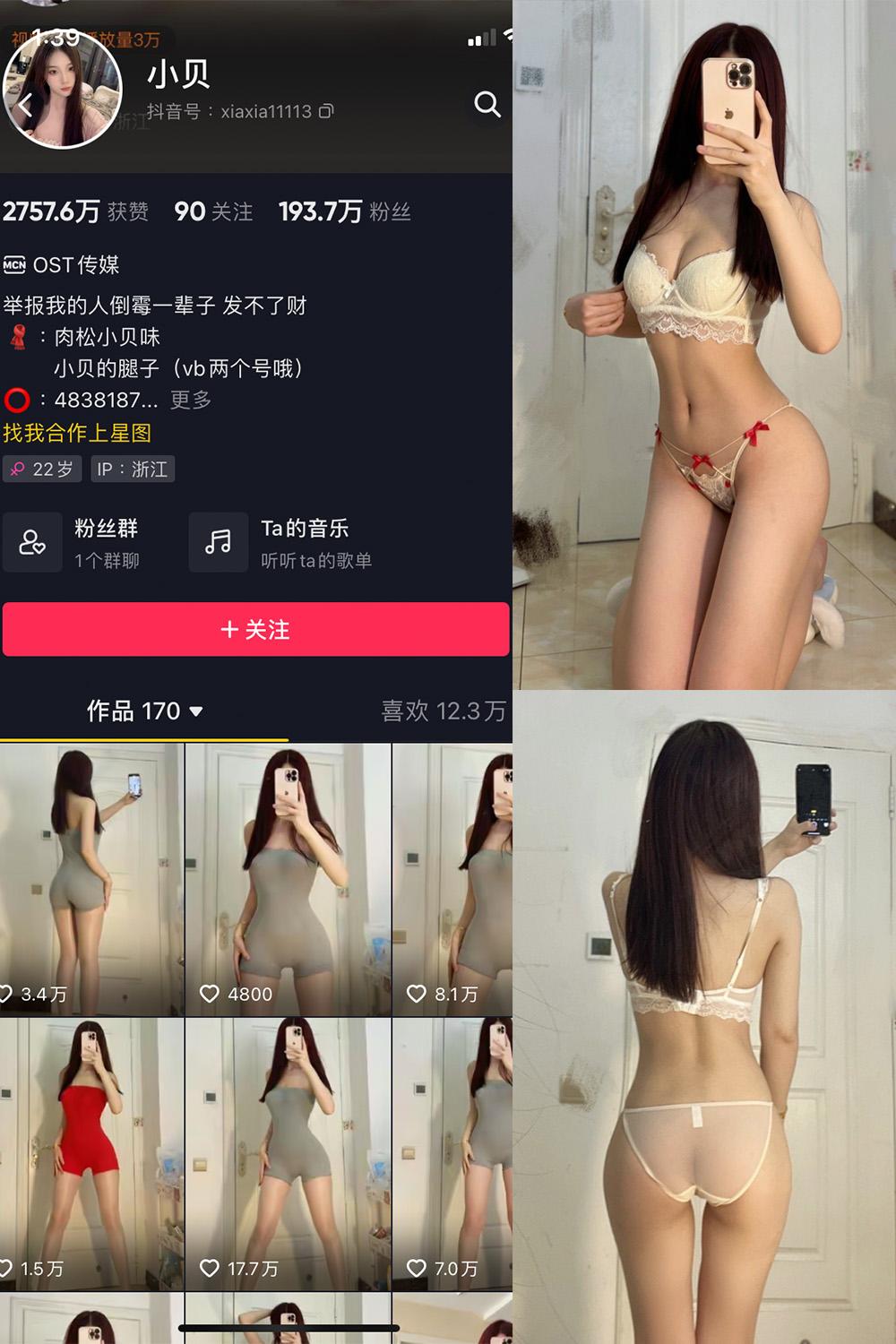 抖音 小贝 VIP 微密圈图包资源  NO.009期 【11P】