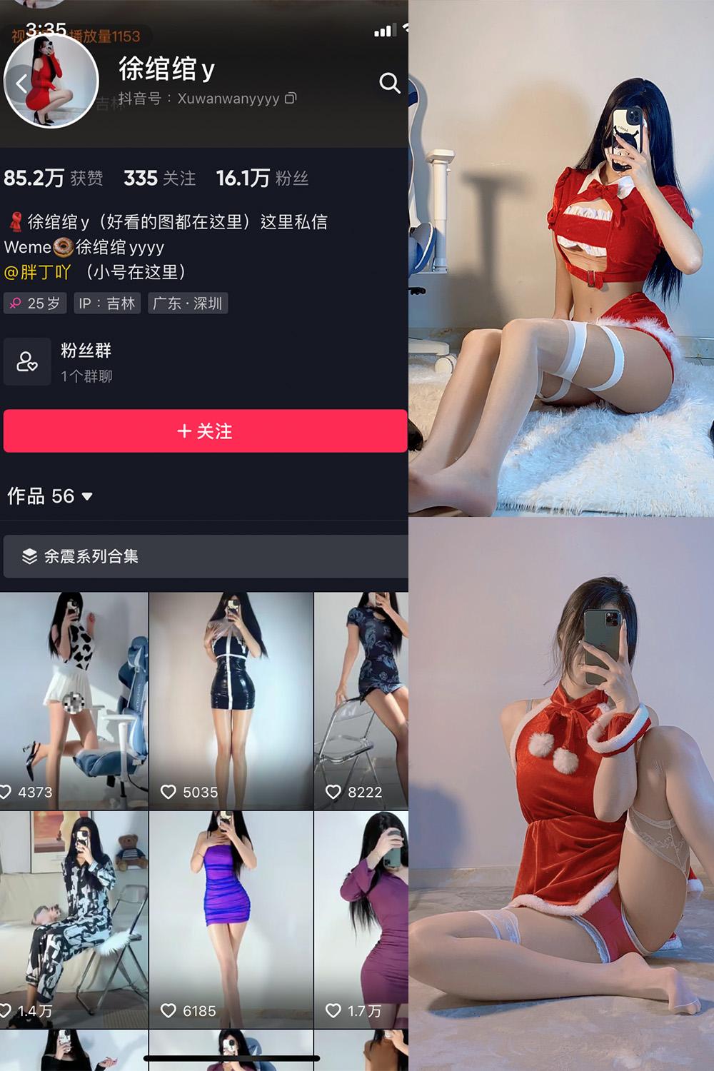 抖音 徐绾绾 微密圈图包资源  NO.010期 【18V】