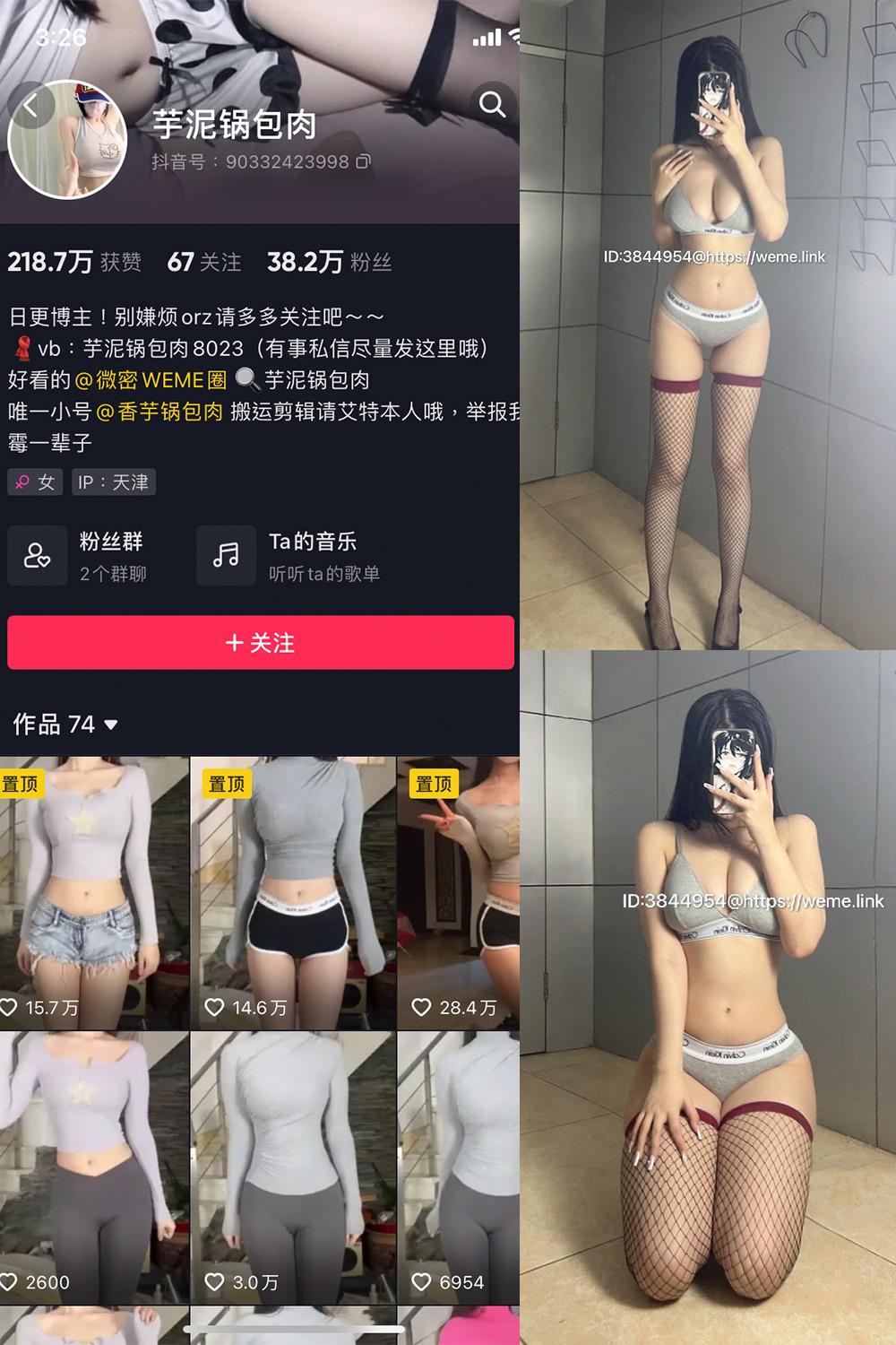 抖音 芋泥锅包肉 微密圈图包资源  NO.005期 【16P9V】