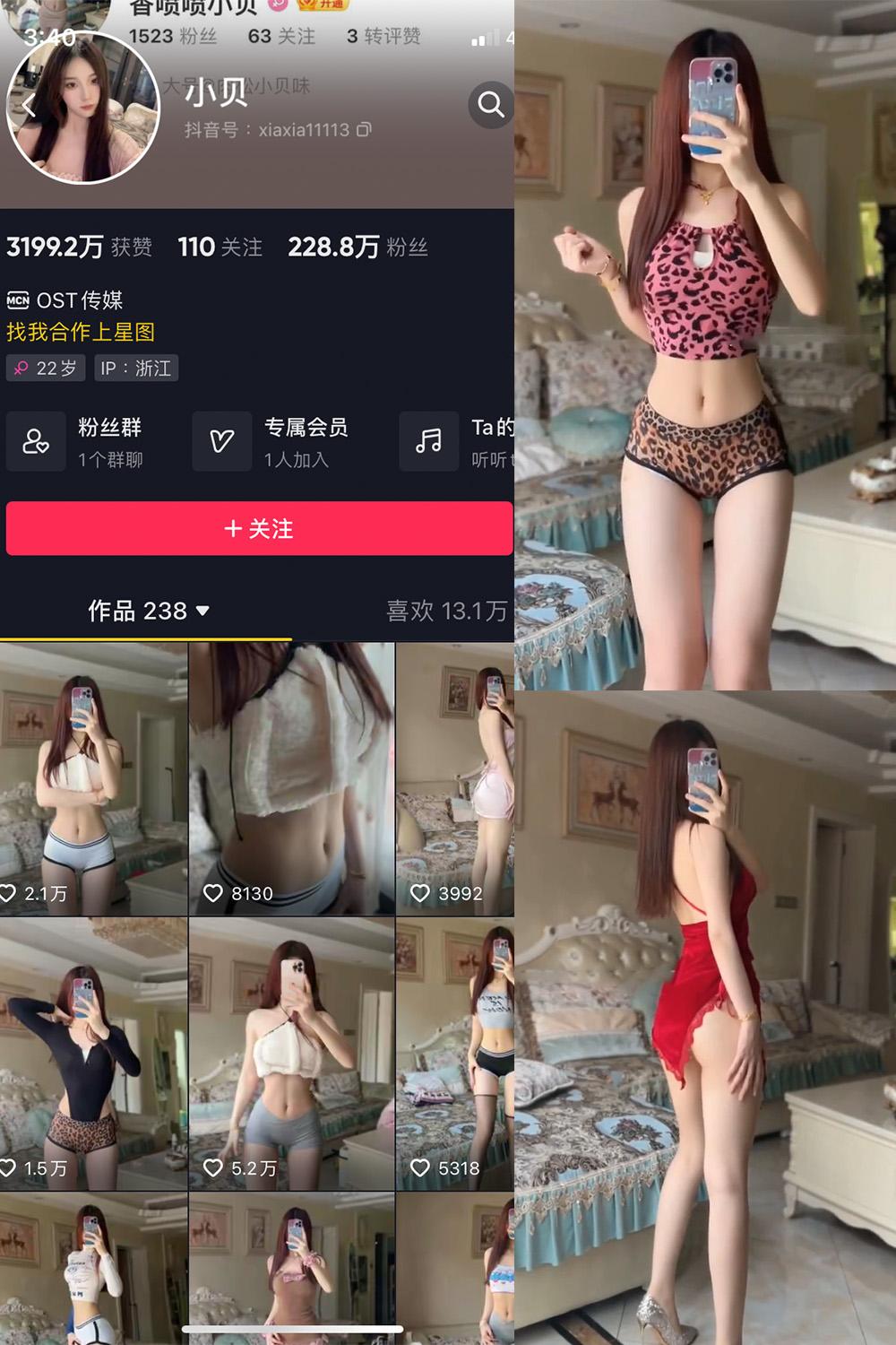 抖音 小贝 VIP 微密圈图包资源 NO.015期 【3P4V】
