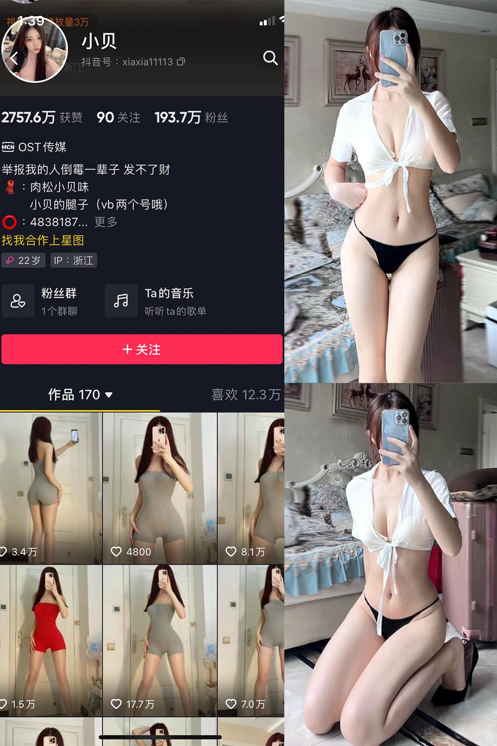 抖音 小贝 VIP 微密圈图包资源  NO.005期 【28P】