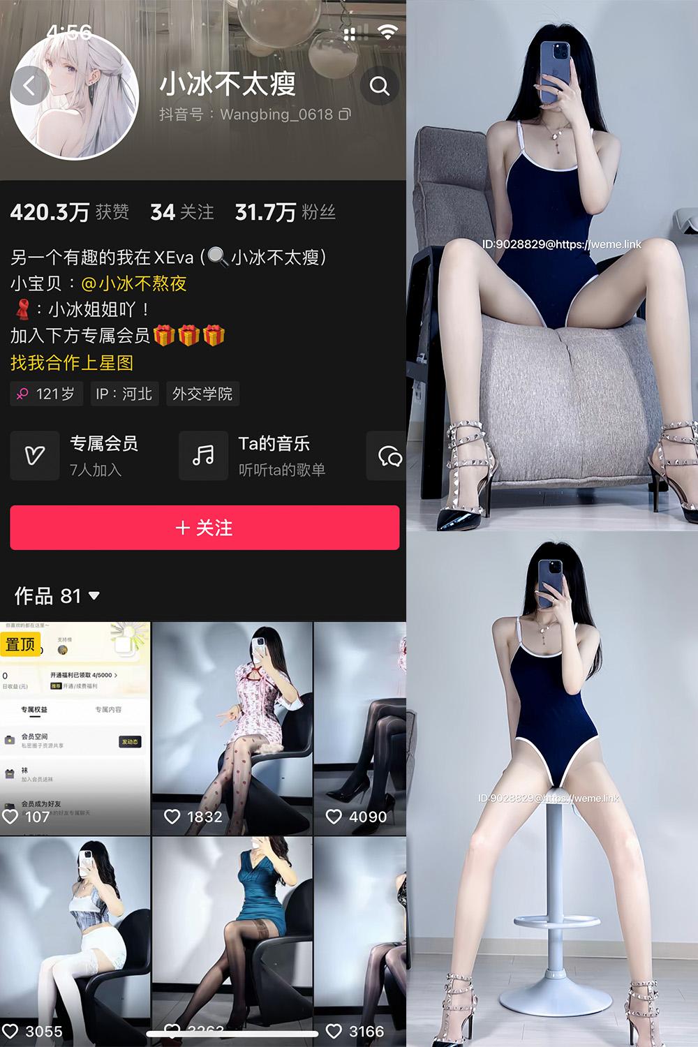 抖音 小冰不太瘦 微密圈图包资源 NO.034期 【18P2V】