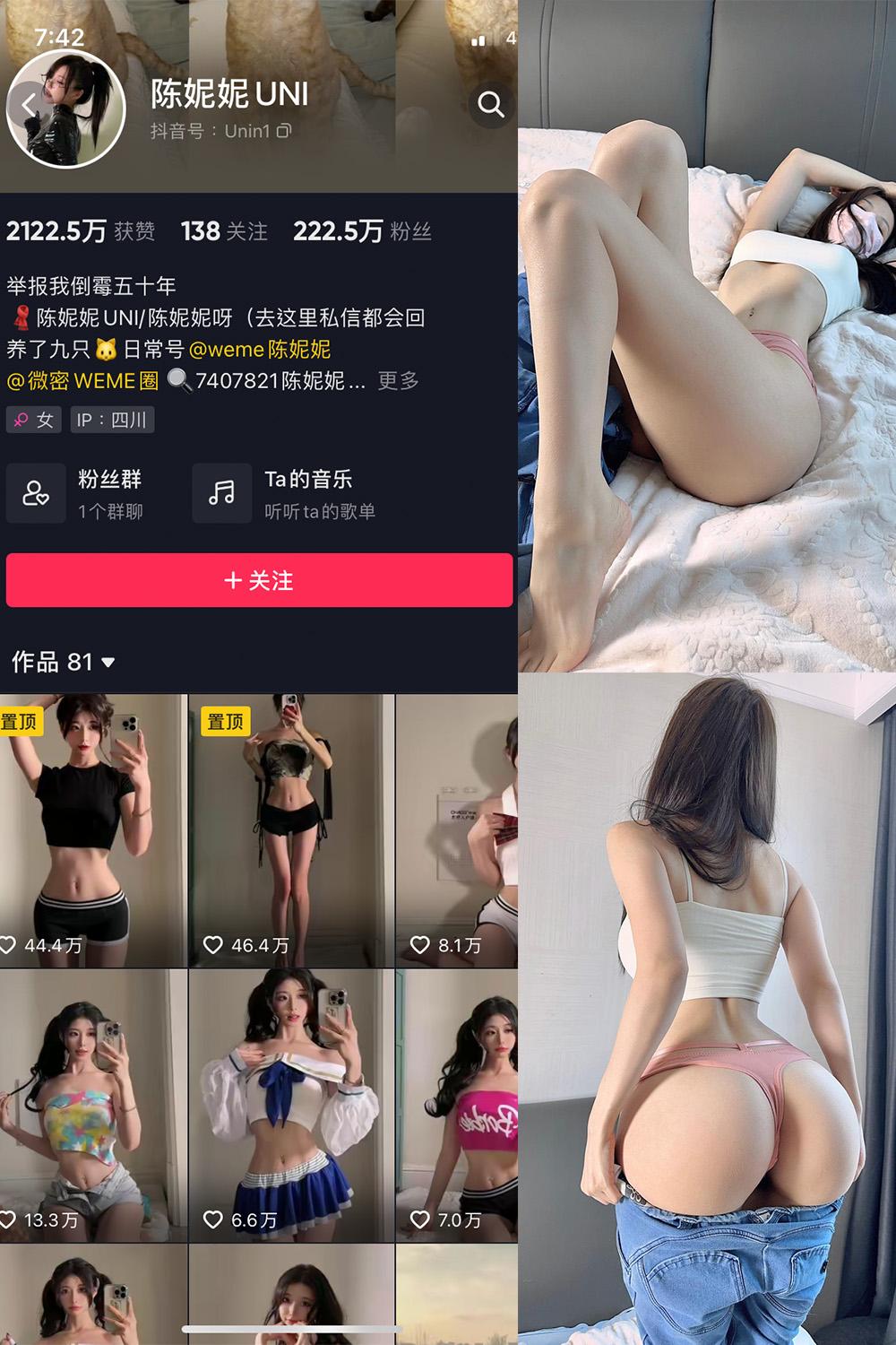 抖音 陈妮腻UNI 微密圈图包资源  NO.069期 【37P2V】