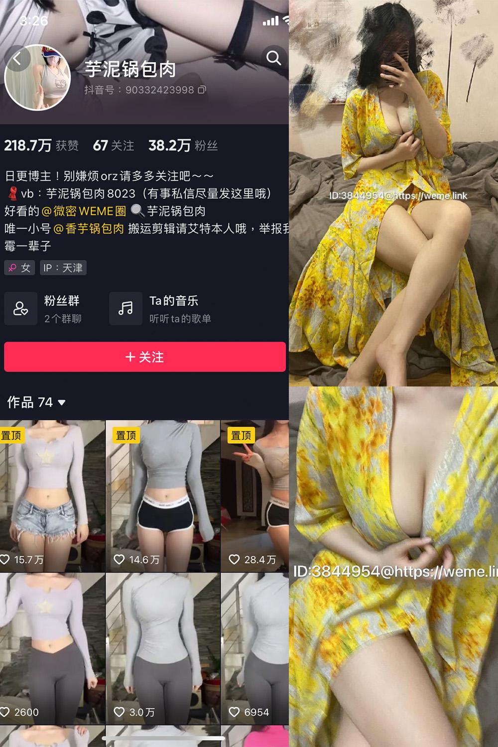 抖音 芋泥锅包肉 微密圈图包资源  NO.010期 【4P】