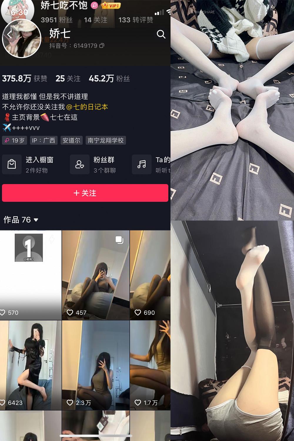 抖音 娇七  微密圈图包资源  NO.004期 【63P】