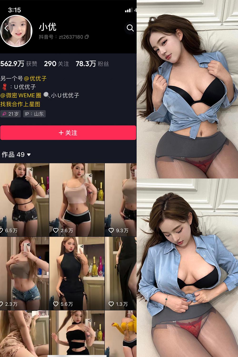 抖音 小U优优子 VIP 微密圈图包资源 NO.057期 【18P2V】