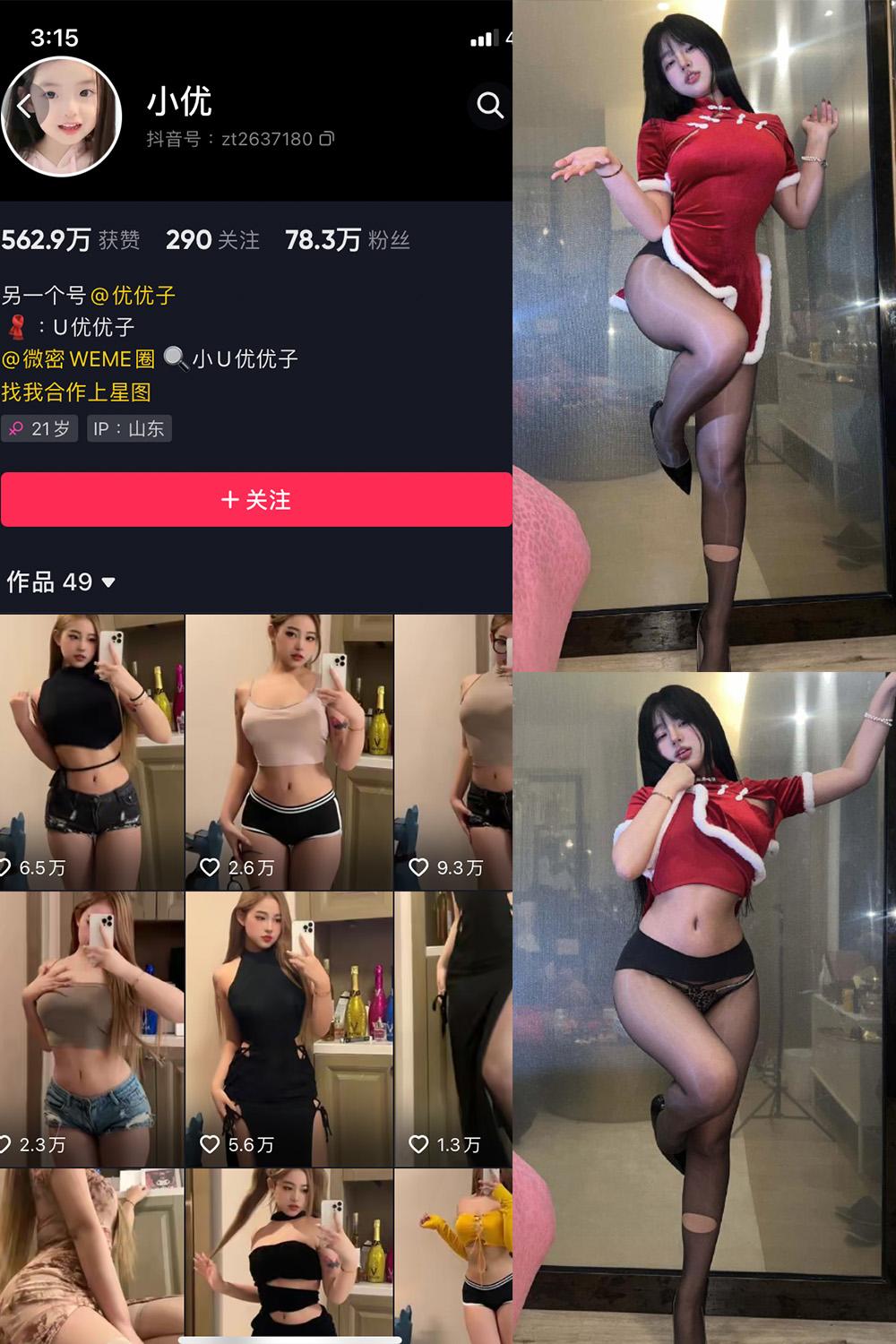 抖音 小U优优子 VIP 微密圈图包资源  NO.037期 【9P1V】