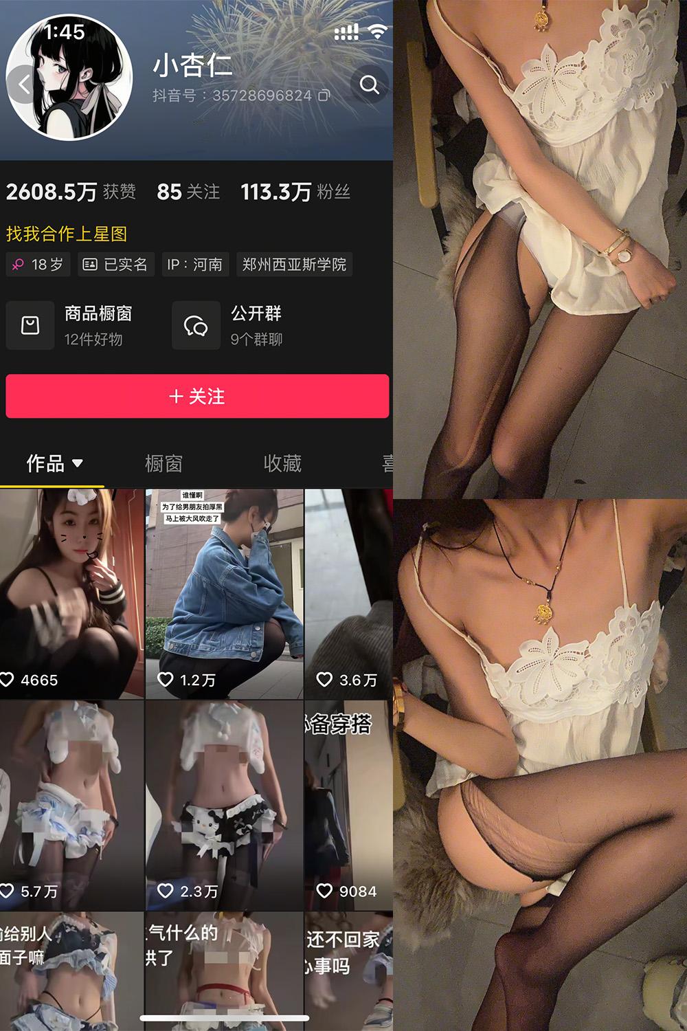 抖音 小杏仁 微密圈图包资源  NO.005 【71P1V】