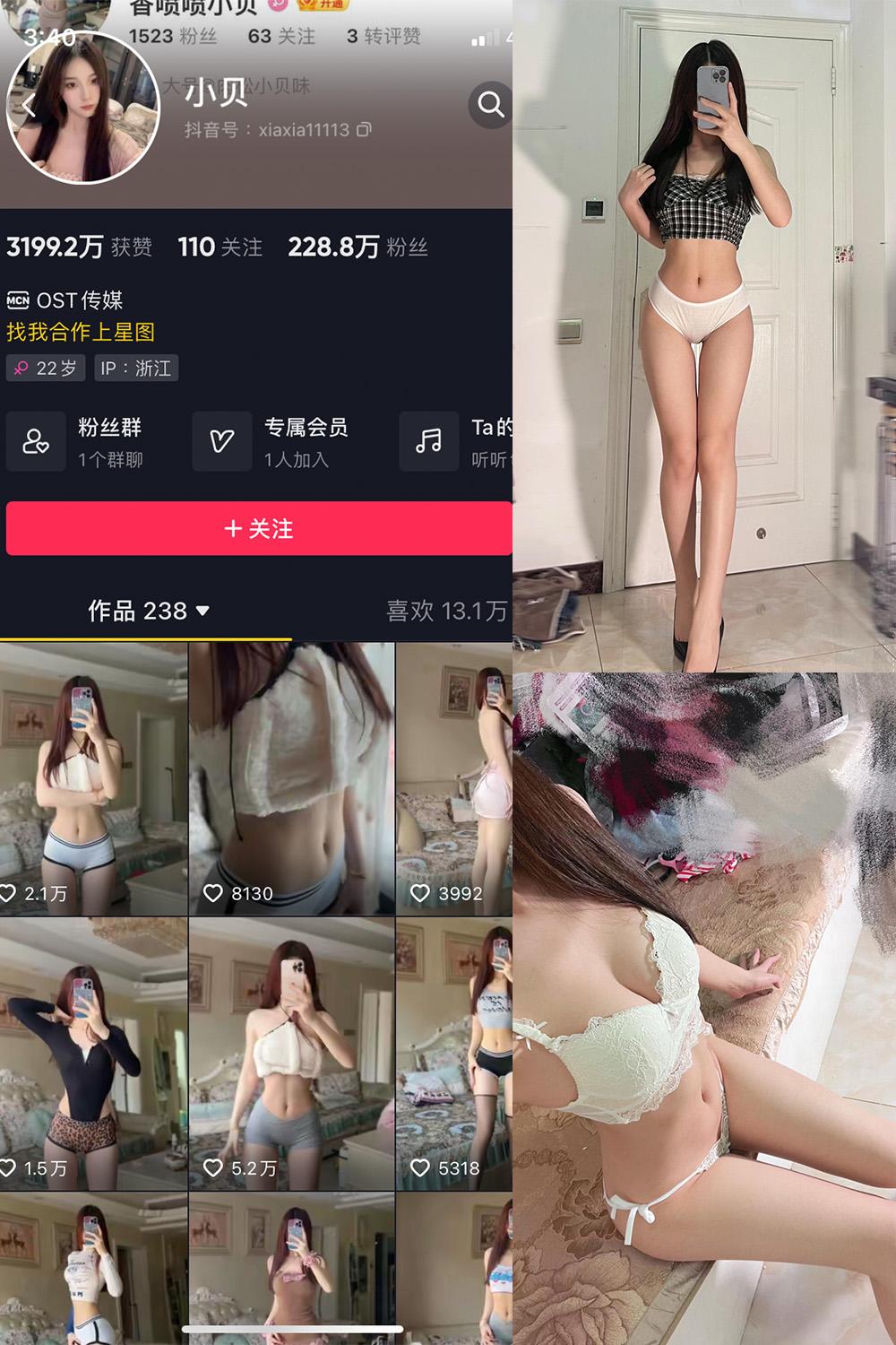 抖音 小贝 VIP 微密圈图包资源 NO.012期 【25P4V】