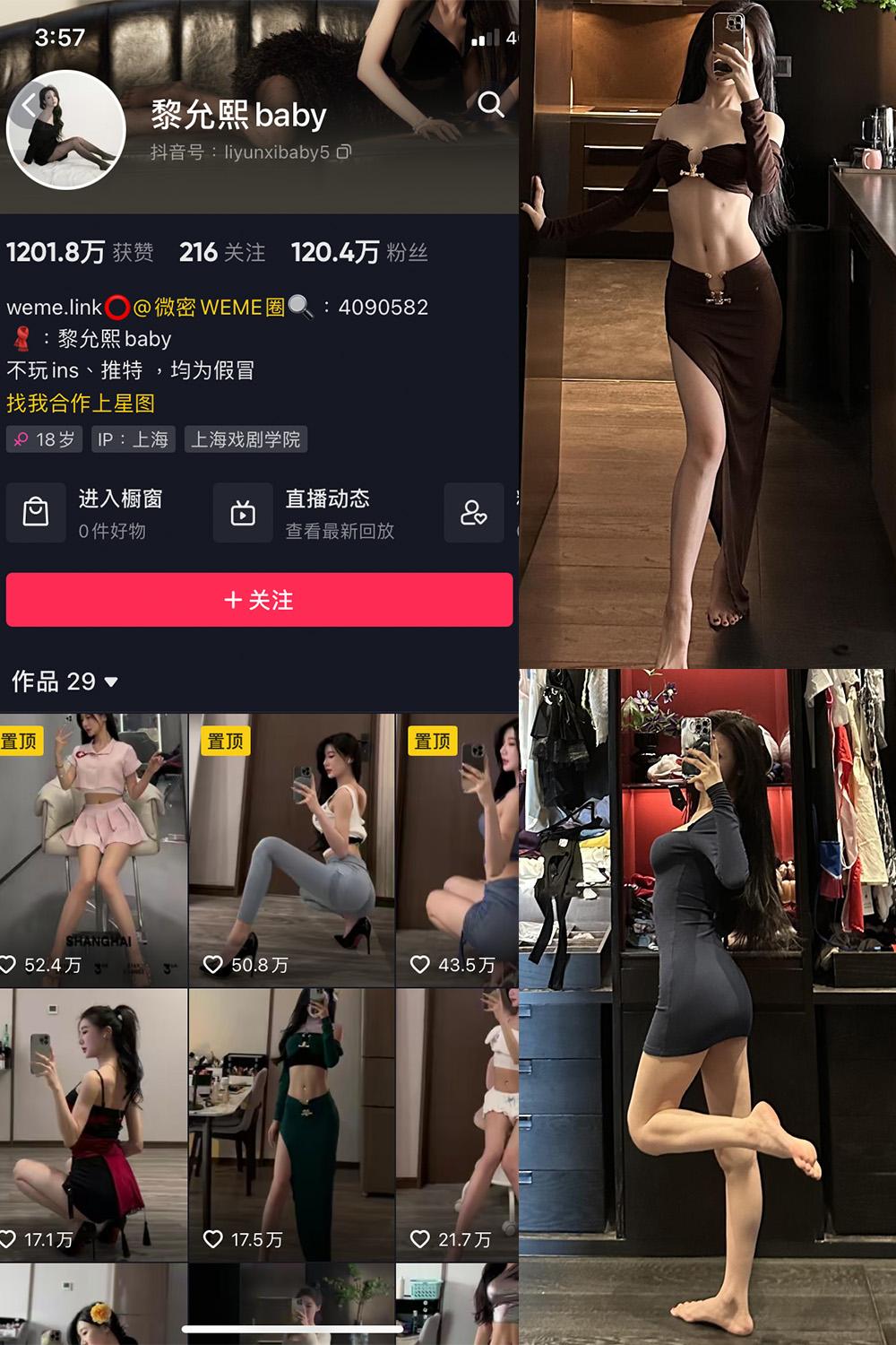 抖音 黎允熙baby 微密圈图包资源  NO.032期 【26P4V】