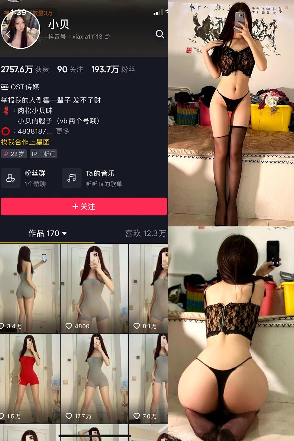 抖音 小贝 VIP 微密圈图包资源  NO.006期 【19P】