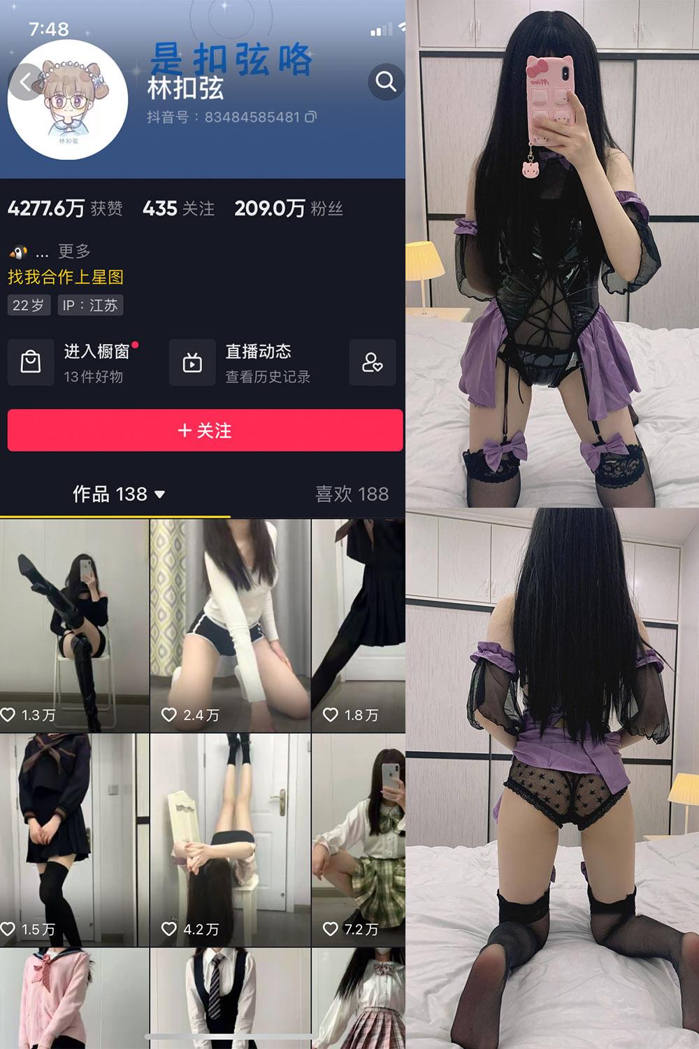 抖音 林扣弦 微密圈图包资源 NO.041期 【31P】