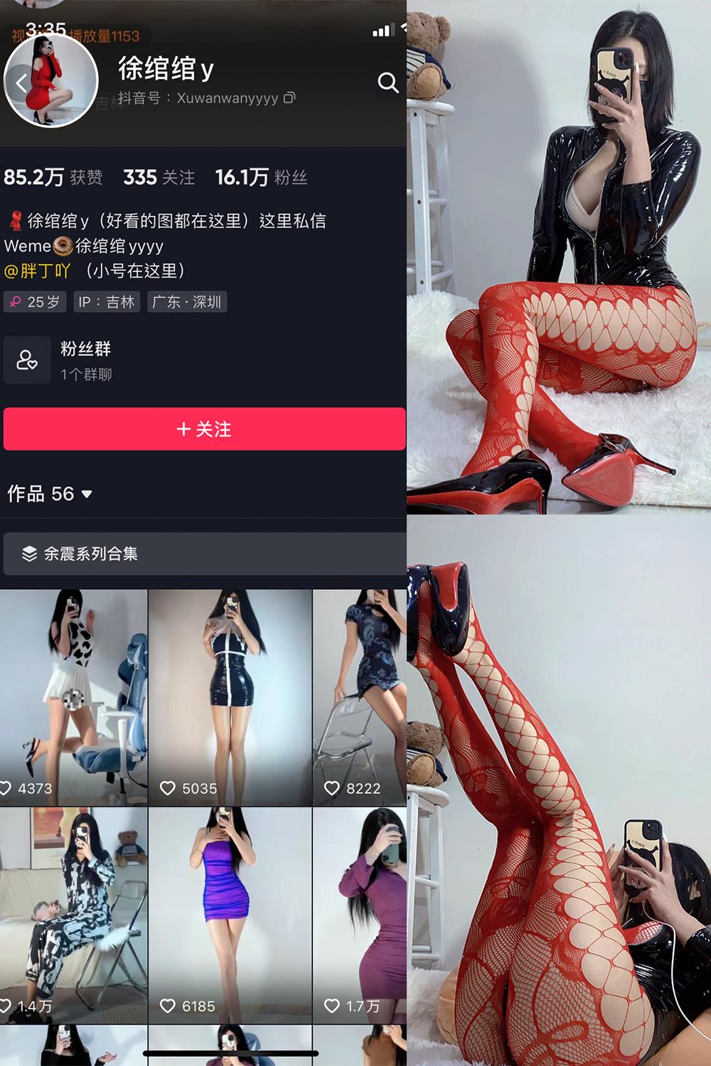 抖音 徐绾绾 微密圈图包资源  NO.009期 【18V】