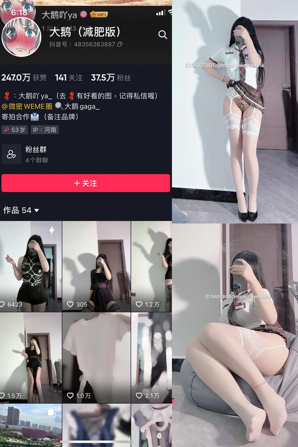 抖音 大鹅gaga 微密圈图包资源  NO.005期 【15P】