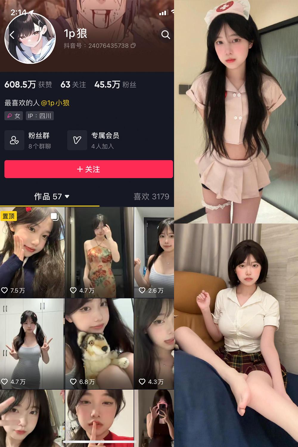 抖音 1p狼 微密圈图包资源  NO.006期 【12P3V】