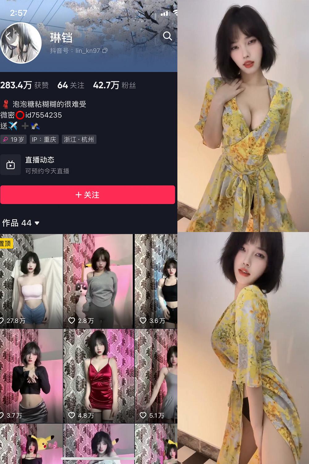 抖音 琳铛 微密圈图包资源  NO.016期 【10P3V】