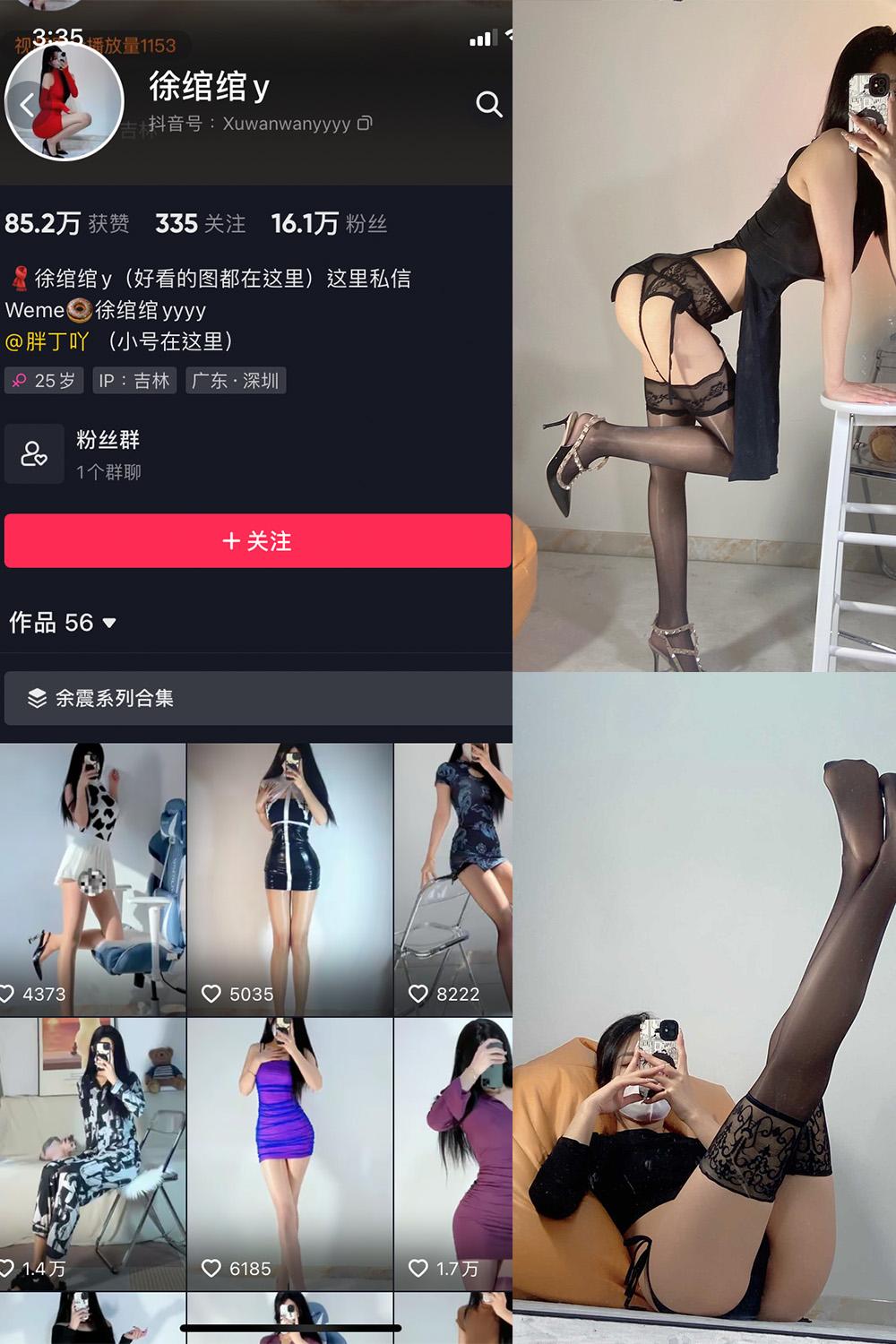 抖音 徐绾绾 微密圈图包资源  NO.004期 【44P】