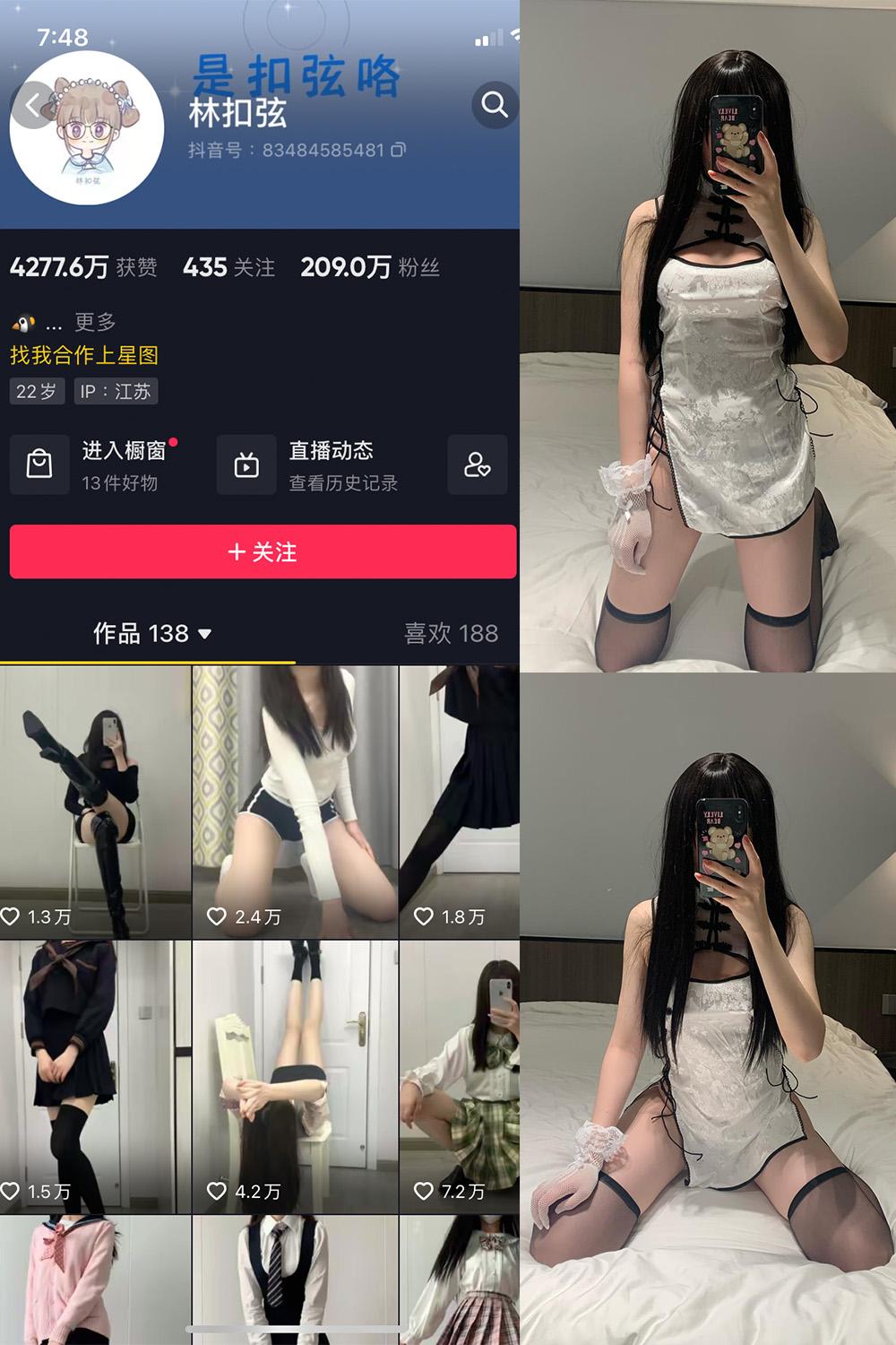 抖音 林扣弦 微密圈图包资源 NO.045期 【2V】